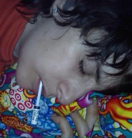 Niki sleeping in great pain looking ill with a fentanyl lollipop in her mouth